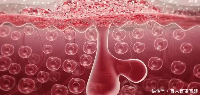 水杨酸|那些脸上没瑕疵的人,都在“酸”些什么