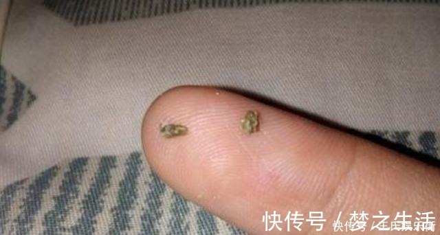 散散步|孩子被嘲笑“嘴太臭”,被同学孤立,医生取出小颗粒,宝妈都嫌臭