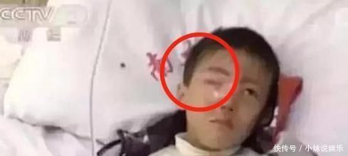 孩子|半小时内,8岁儿子眼睛被融化,宝妈得知原因后当场泪崩对不起
