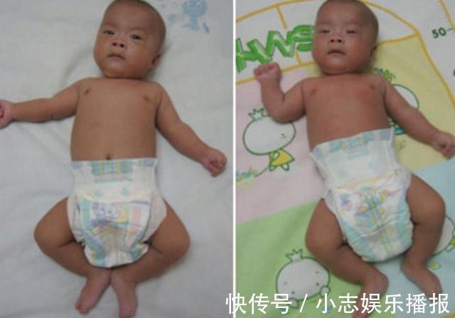 妈妈|宝宝的便便,若出现了4种情况,妈妈要学会自己判断!