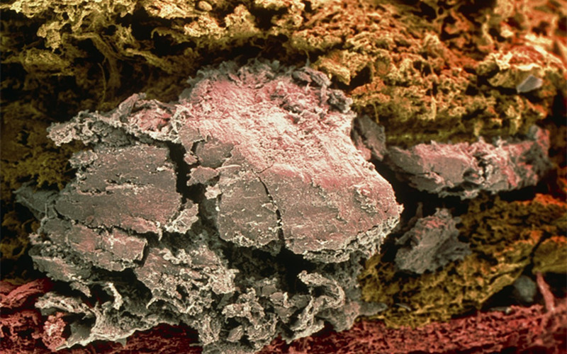 寿命比较短的人,身上这两处比较硬,如果你一个都不占,那恭喜你