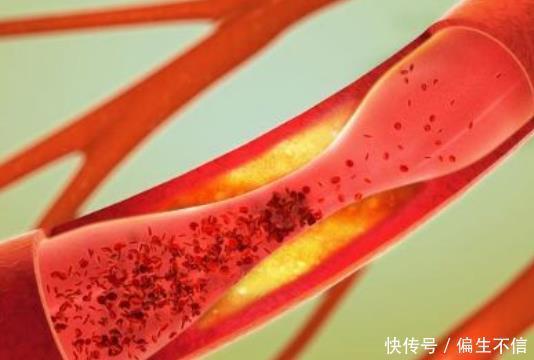  心脏病|头部显现7个“异象”，劝你去体检一下，心脏可能“负重难行”