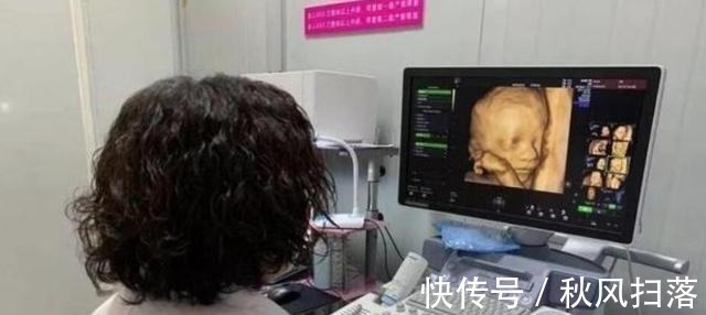 算数|“天才”胎儿走红,还在妈妈肚里就会“算数”,医生清华北大等你