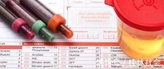 肾脏|尿常规检测中,这项指标能预示早期肾病的发生!不是尿蛋白