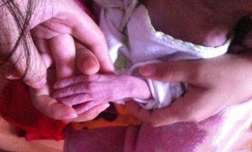 医生|宝宝出生25天就像个小老头,医生的一席话,让父母恨自己也太不上心了