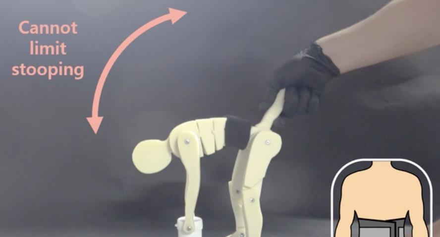 膝关节|这套“人造肌腱”装备,可保护你的老腰|Science子刊