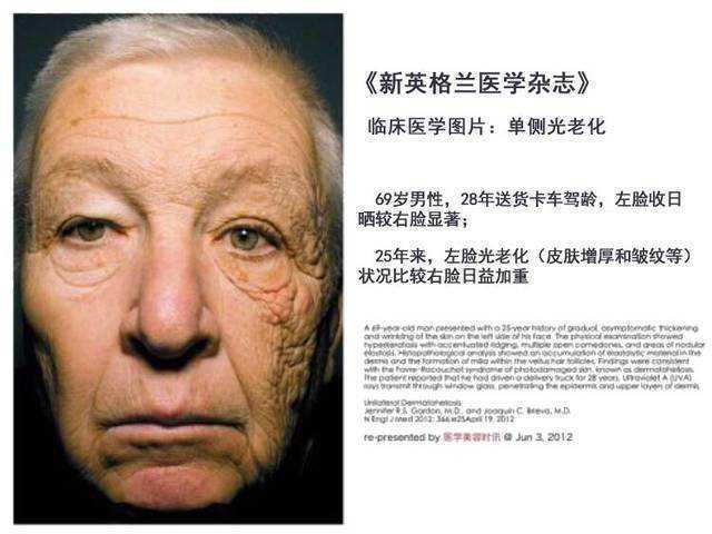 护肤品越用越多,肌肤状态急剧下滑,护肤品真的有效