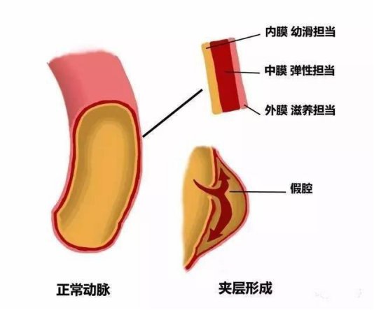  突然“心如刀割”？警惕冬季的“隐形杀手”！|二十四节气·冬至 | 隐形