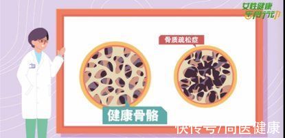青春期|守好三大“关卡”让骨质疏松症绕着女性走