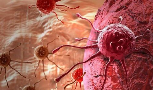 癌前病变|癌症并非突如其来身上这5个不起眼的小症状,早已通知你