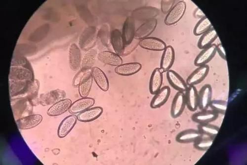 3岁宝宝晚上哭闹说“屁屁痒”,妈妈脱下裤子一看,有东西在动