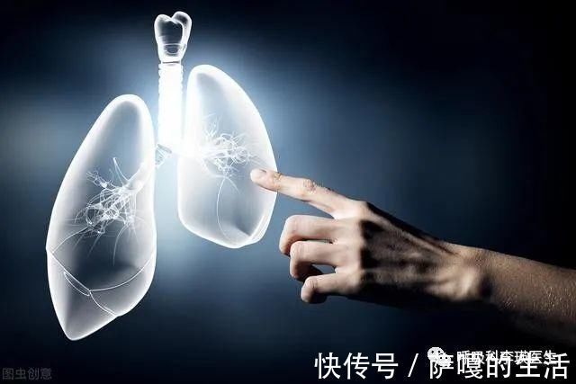 肺癌|查到肺结节就是早期的肺癌?关于肺结节的13个常识问答,你知道吗?