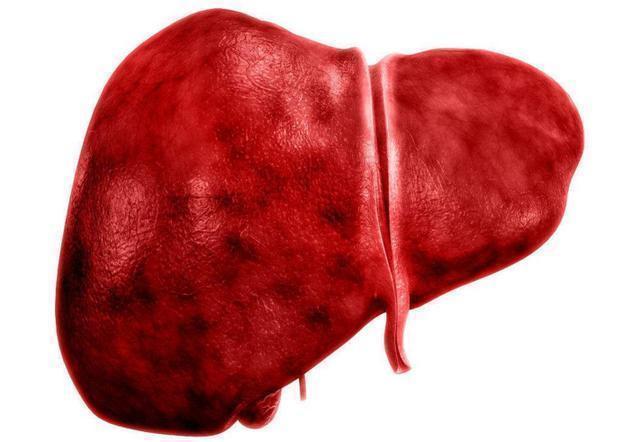 鱼蟹毒|姜是肝肿瘤的“罪魁祸首” 专家终于说了大实话