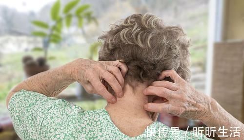 扫帚苗|一个用了30年的黄金搭档，2味药强强联合，从根治愈皮肤瘙痒！