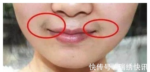 女人|女人有没有妇科病,看嘴巴或许就知道,对照自测,希望你一个没有