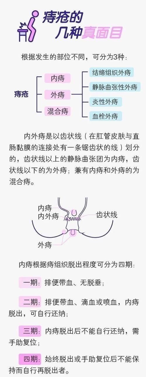 成年人|成年人的难言之隐：关于“痔疮”，那些不可描述的秘密