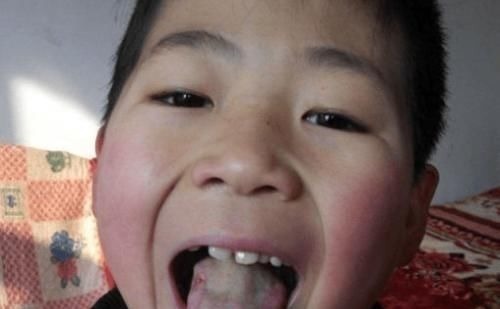 积食|这3种行为或正“偷走”孩子身高,医生:父母无知耽误孩子!