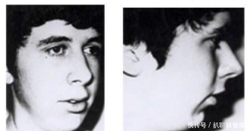 孩子|用嘴呼吸会变丑?父母看到宝宝用嘴呼吸要即使制止!