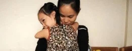 海豹胎|产检时发现胎儿没有手脚,妈妈坚持生下来,如今女孩十岁让人感慨
