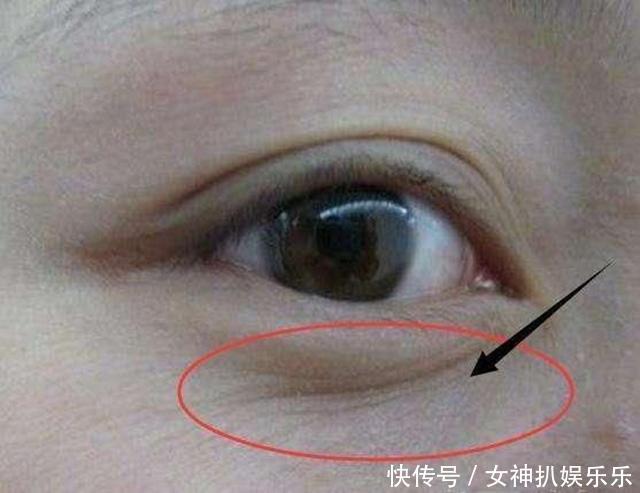 护肤|百无一用是眼霜