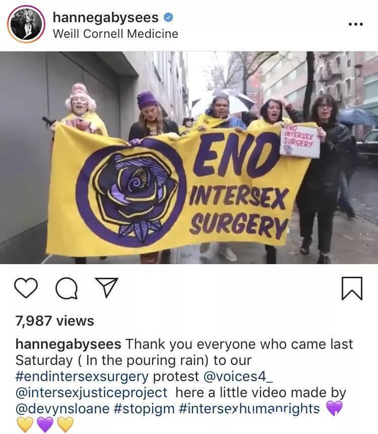 挑战性别界线,“雌雄同体”在超模圈是种怎样的存在