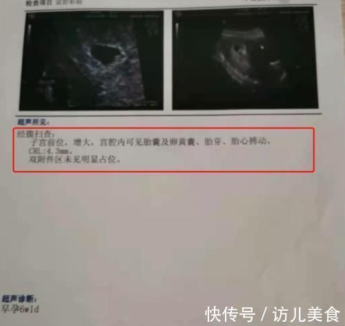 胎位|孕期做几次B超?各B超单信息代表什么?孕妈要搞清楚