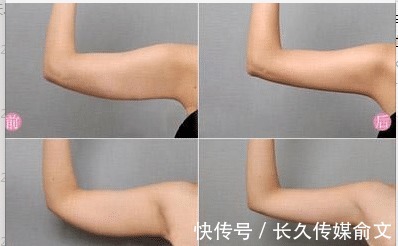 拉力绳|胖奶奶71岁开始健身,坚持3年减掉56斤:改变自己,无关年龄