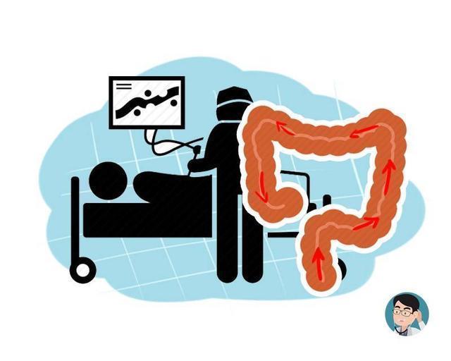  每天排便多，肠癌风险高？一份50万人的研究，或能得到答案