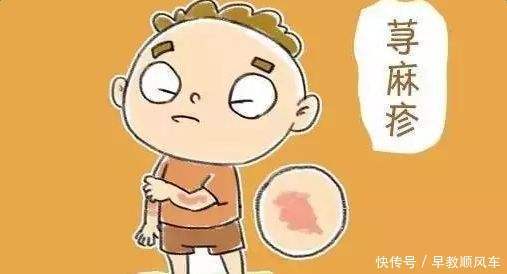 过敏性荨麻疹|冬季荨麻疹的反复发,可以坚持做这三点,持续减缓有希望