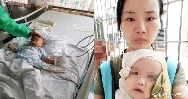 男婴脸上长了一个红疙瘩，后被切除半张脸，10天后又确诊癌症