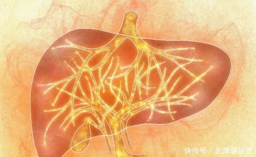 脂肪肝|肝不好别吃药,多吃5种食物,给肝脏“大扫除”,肝越来越好!