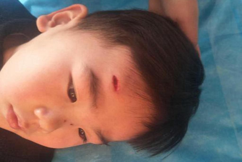 受伤|母亲“生产痛”高达十二级,孩子的“忍痛超能力”竟也超乎想象