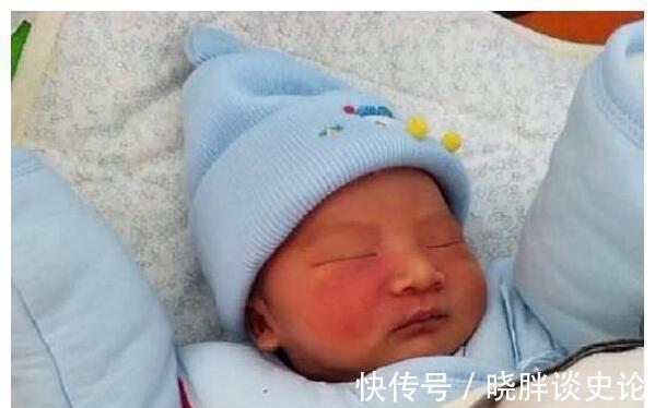 小女孩|宝宝的胎记怎么来的?产科医生:孕期这2种行为易长胎记,要避开