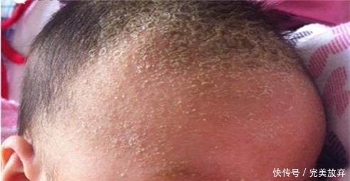 婴儿囟门|宝宝这5个部位坚决不能乱碰,当你知道后悔都晚了!