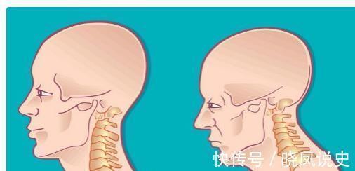 阳气|脖子长出“富贵包”,瞬间老10岁!简单3个动作,教你改善富贵包