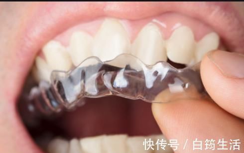 牙齿|孩子换牙齿,新长的牙齿却是歪的,可能是家长这些没做好