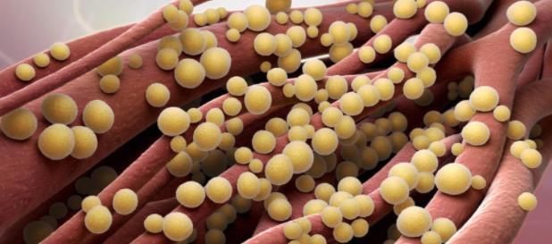 卫生巾|14岁少女用卫生棉后,竟然意外身亡,妇科专家提醒一定要及时更换