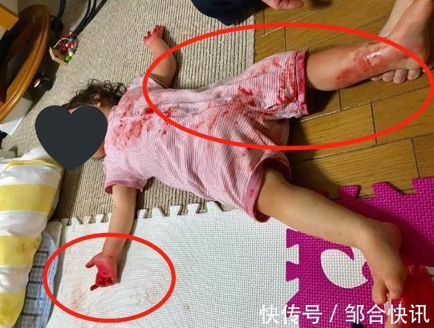 小蕊|妈妈拿快递回家,眼前这幕让她情绪失控4岁女儿躺在“血泊”中