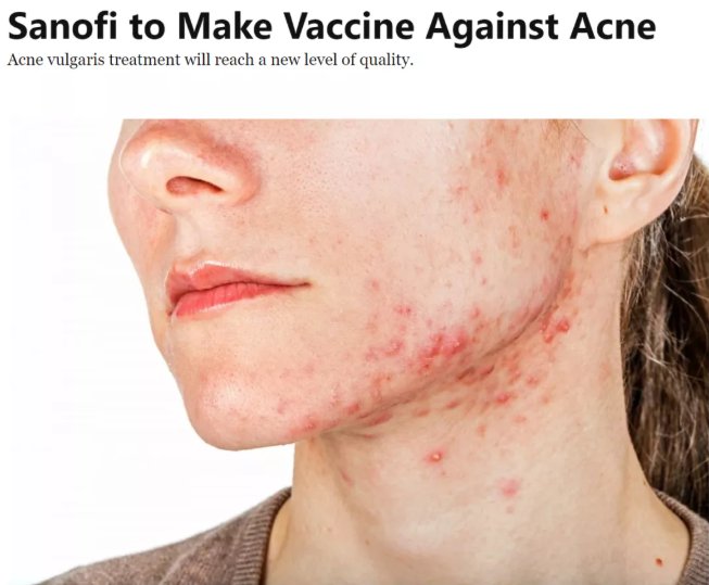 皮肤科|痘痘疫苗要来啦？这类痘痘患者才最需要它