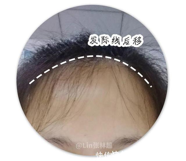 刘海|别再留显脸大的发型了!这2款,照着剪美炸了丨粉丝发型改造