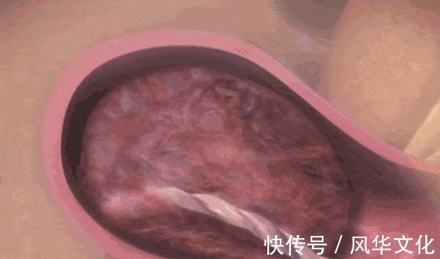 胎膜|顺产到底有多疼,给你们看完这18图片,就能真正理解女人不容易
