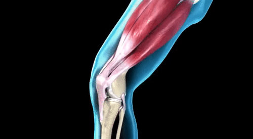 运动损伤|「半月板」最怕的一个动作，分分钟加速它的“报废”！