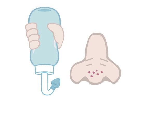 鼻腔|鼻腔冲洗对鼻炎患者来说有什么作用呢?主要是这4个方面