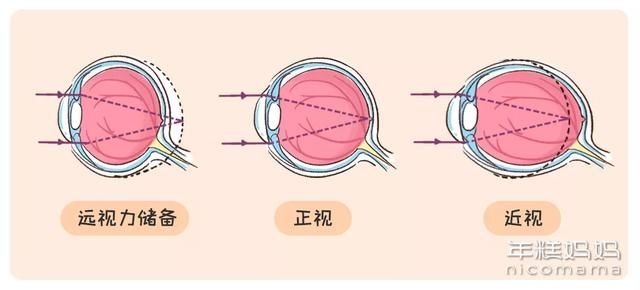 视力|不看电视不玩iPad，娃还是近视了？该如何帮孩子做真正的近视预防