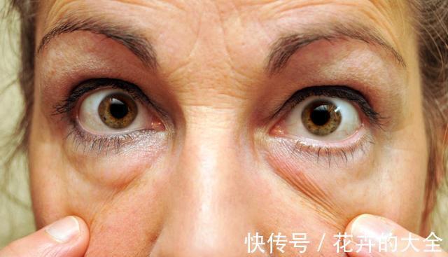 小动作|清晨有4大现象，多半是湿气太重了，坚持2个小动作，轻松祛湿