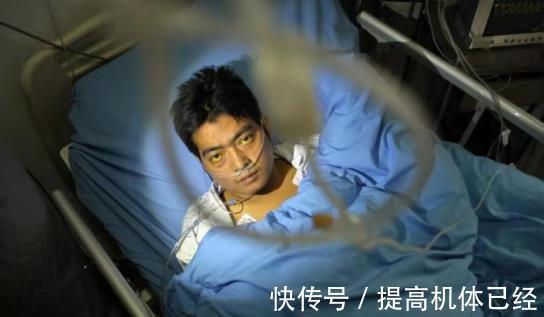 胆红素|“上肢”出现这种征兆,应尽早检查肝功能,或是肝脏病变“信号”