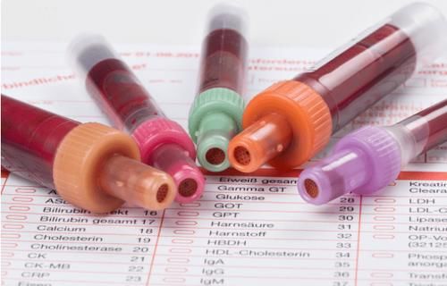 指标|预防尿毒症除了降肌酐，医生提醒：4项指标稳住，肾功能更有保障