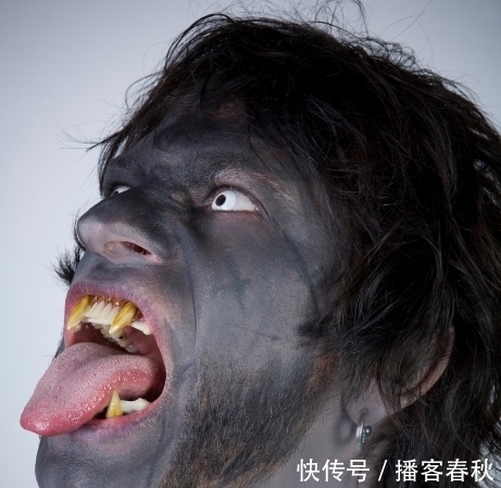 怪物|七岁男孩嘴中有526颗牙齿,医生花费5小时取出,和怪物没区别