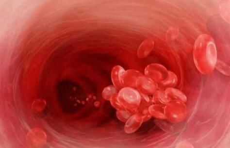 粘稠|身体出现这些症状, 你的血液已很粘稠了, 现在发现还不晚!