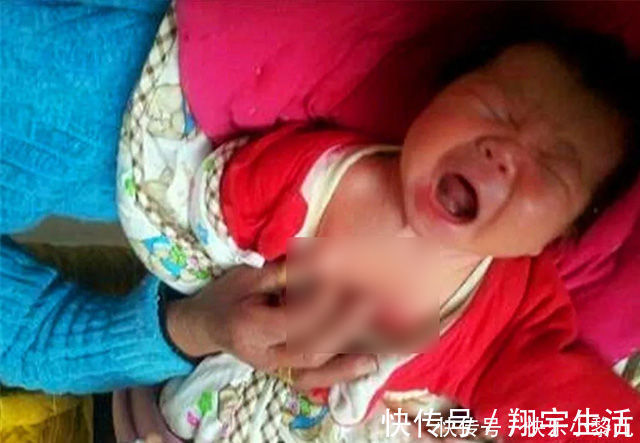 宝宝|新生儿双脚大面积蜕皮,宝妈火急火燎跑医院,医生看到却很淡定